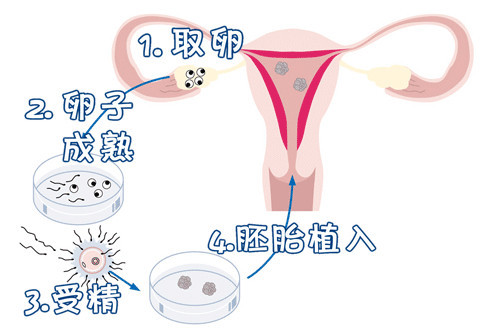 青瓷医疗